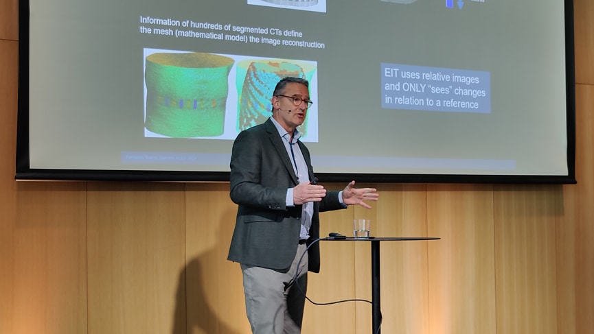 EIT – a new tool for individualized ventilation