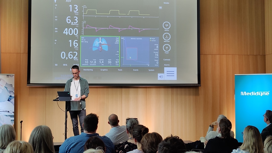 Is closed loop ventilation a solution for individualized ventilation, and can transpulmonary pressure be a part of this?